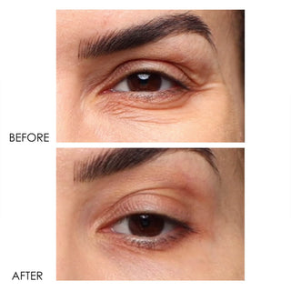 REVITALITE PROFESSIONAL Eyelid & Dark Circle Corrector