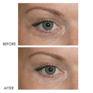 REVITALITE PROFESSIONAL Eyelid & Dark Circle Corrector