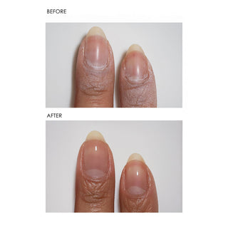 Extracts Before and After