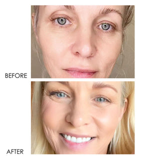 SELF-ESTEEM Beauty Sleep Serum Before and After