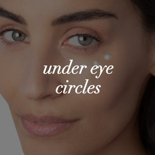 under eye circles